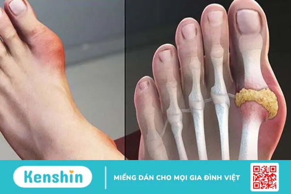 11 tác dụng của nấm lim xanh tốt cho sức khỏe và cách dùng an toàn