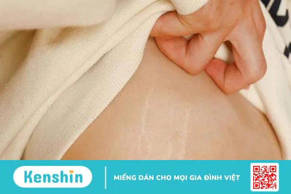 11 tác dụng của rau má bạn không nên bỏ qua