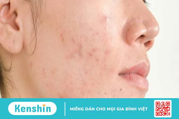 11 tác dụng khi uống Glutathione với Vitamin C giúp trắng da hiệu quả