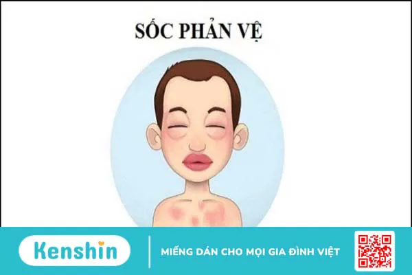 11 tác dụng phụ của aspirin và lưu ý khi sử dụng thuốc an toàn