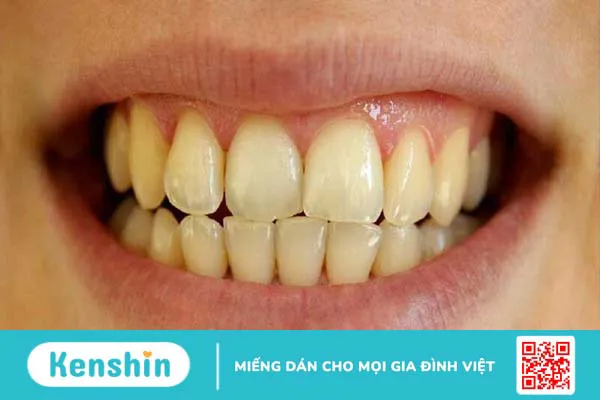 11 tác hại của thuốc lá tới sức khỏe và mọi người xung quanh