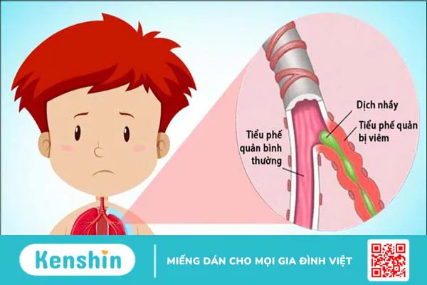 12 bệnh giao mùa thu đông thường gặp ở trẻ và cách phòng ngừa hiệu quả