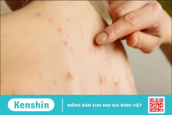 12 bệnh giao mùa thu đông thường gặp ở trẻ và cách phòng ngừa hiệu quả