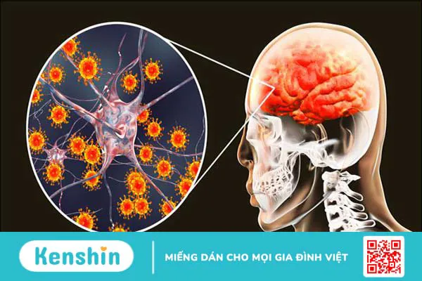 12 bệnh giao mùa thu đông thường gặp ở trẻ và cách phòng ngừa hiệu quả