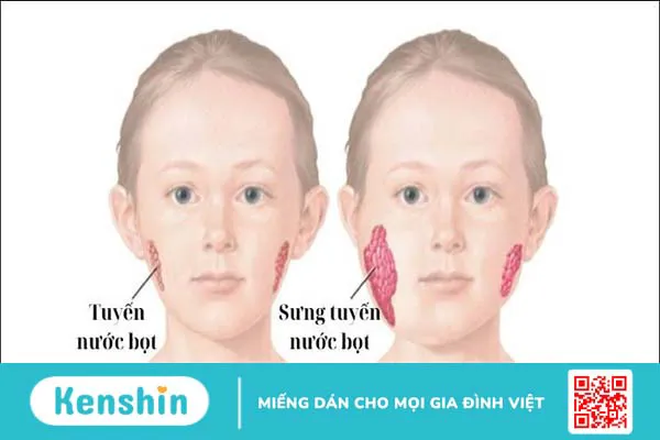 12 bệnh giao mùa thu đông thường gặp ở trẻ và cách phòng ngừa hiệu quả