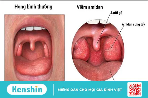 12 biện pháp phòng ngừa bệnh đường hô hấp hiệu quả ngày nắng