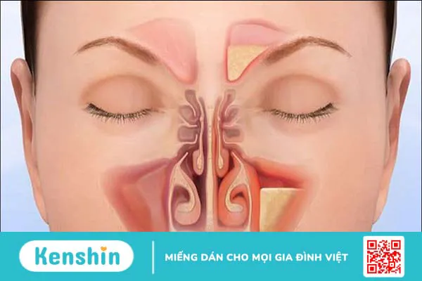 12 biện pháp phòng ngừa bệnh đường hô hấp hiệu quả ngày nắng