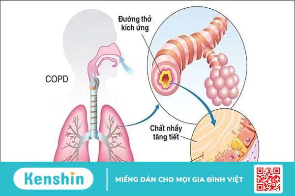 12 biện pháp phòng ngừa bệnh đường hô hấp hiệu quả ngày nắng