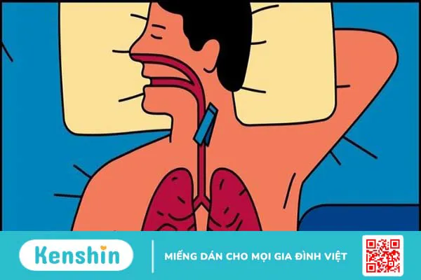 12 cách chữa chứng ngưng thở khi ngủ đơn giản và lưu ý bạn cần biết