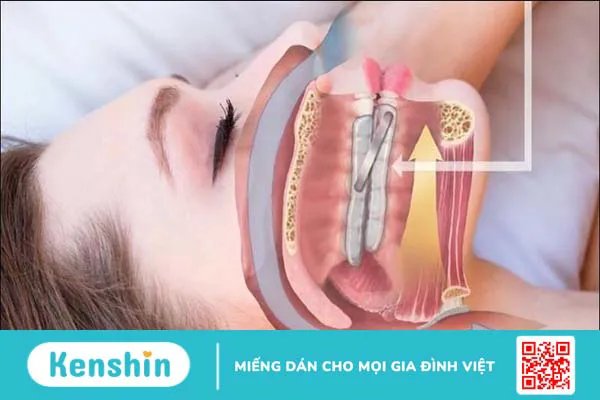 12 cách chữa chứng ngưng thở khi ngủ đơn giản và lưu ý bạn cần biết