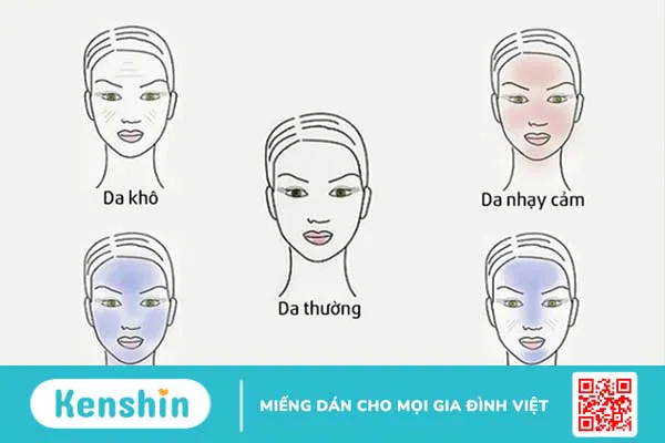 12 cách giảm mụn tại nhà hiệu quả, đơn giản bạn không nên bỏ qua