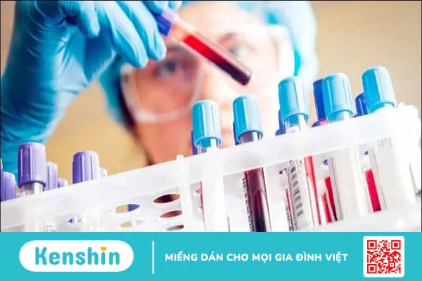 12 cách trị tiểu đêm nhiều lần tại nhà hiệu quả giúp bạn ngủ ngon hơn