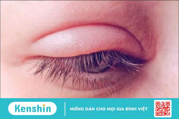 12 dấu hiệu cảnh báo bệnh thận và các thực phẩm nên ăn