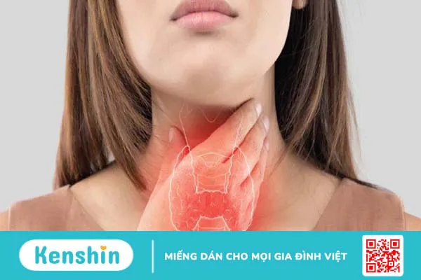 12 dấu hiệu nhận biết bệnh bướu cổ bạn cần chú ý