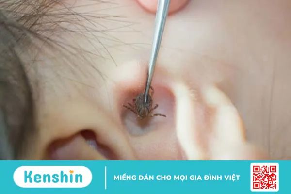 12 loại côn trùng gây bệnh có hại cho người và biện pháp phòng ngừa