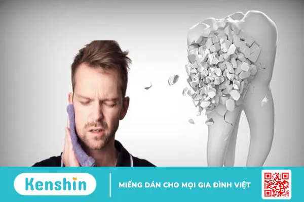 12 nguyên nhân gây răng ố vàng khiến bạn bất ngờ