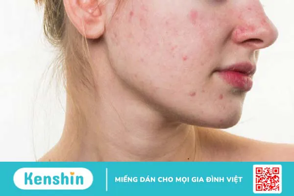 12 tác dụng của nước hoa hồng giúp nàng khỏe đẹp mỗi ngày