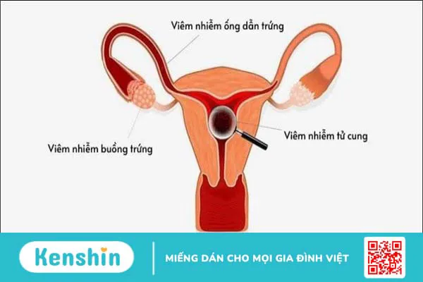 12 tác hại của thuốc phá thai đối với sức khỏe bạn cần biết