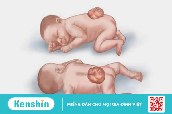 12 tác hại của thuốc phá thai đối với sức khỏe bạn cần biết