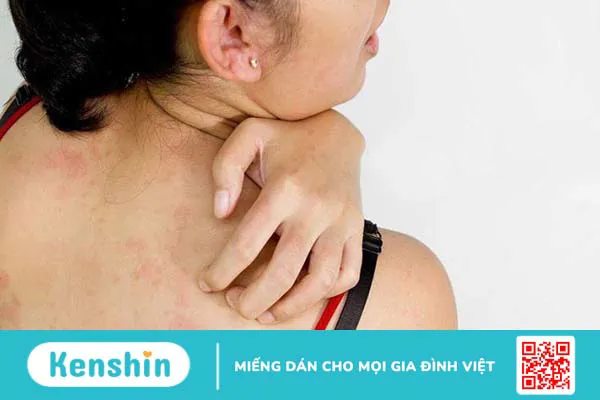 12 vấn đề sức khỏe ngày Tết thường gặp và cách phòng ngừa