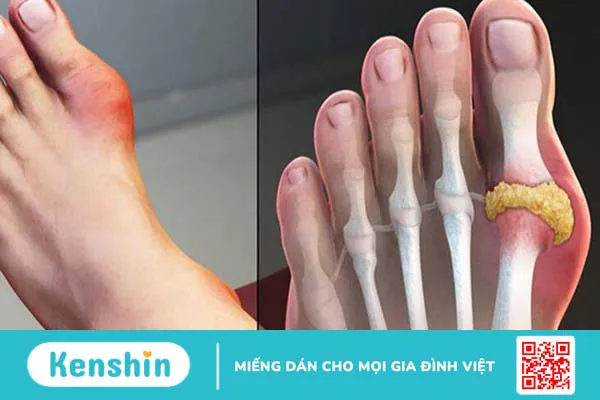 12 vấn đề sức khỏe ngày Tết thường gặp và cách phòng ngừa