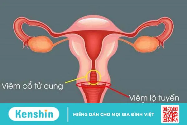 13 biến chứng thai kỳ mẹ bầu cần lưu ý trong thời gian mang thai