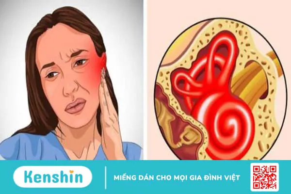 13 cách chữa ù tai tại nhà nhanh, đơn giản và các lưu ý khi bị ù tai