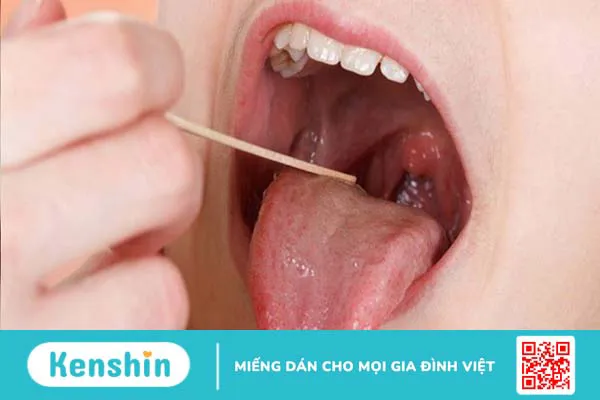 13 cách chữa viêm họng tại nhà từ những nguyên liệu dễ làm