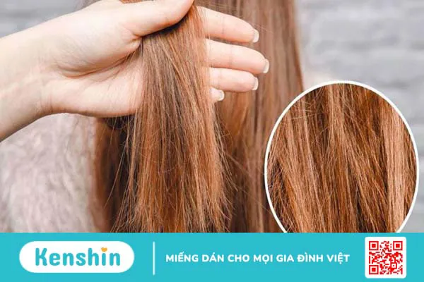 13 dấu hiệu bệnh tuyến giáp bạn cần chú ý