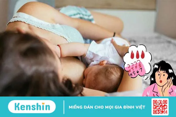 13 nguyên nhân chậm kinh mà không có thai bạn nữ cần lưu ý