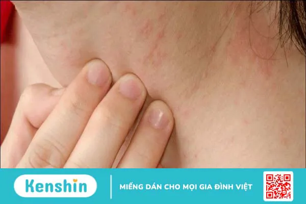 13 nguyên nhân ngứa đầu dương vật có thể bạn chưa biết