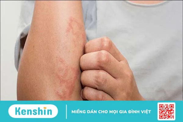 13 nguyên nhân ngứa đầu dương vật có thể bạn chưa biết