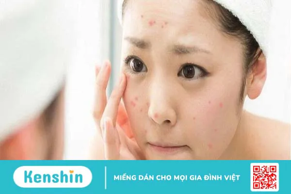 13 sai lầm khi rửa mặt khiến da nổi mụn, lão hóa sớm chị em nên tránh