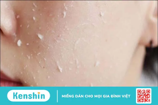 13 sai lầm khi rửa mặt khiến da nổi mụn, lão hóa sớm chị em nên tránh