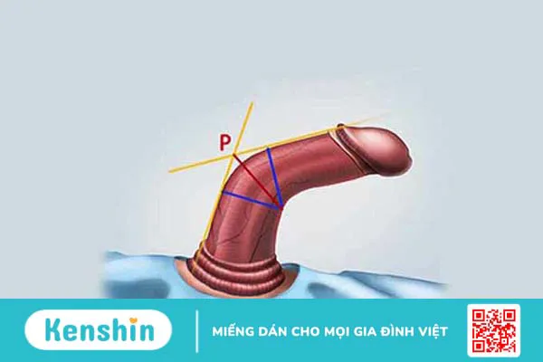 13 Sự thật về dương vật có thể bạn chưa biết