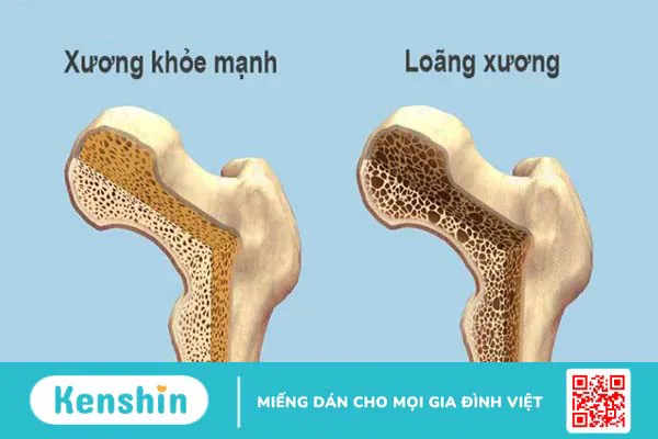 13 tác dụng của mùi tây đối với sức khỏe bạn cần biết