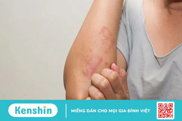 13 tác dụng phụ của dầu cá và lưu ý khi sử dụng