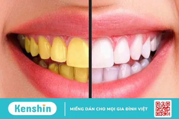 13 tác dụng phụ của thuốc kháng sinh bạn không nên bỏ qua