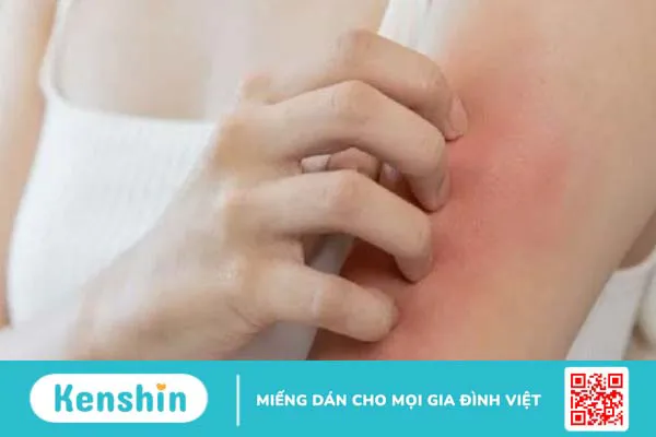 13 tác dụng phụ của thuốc kháng sinh bạn không nên bỏ qua