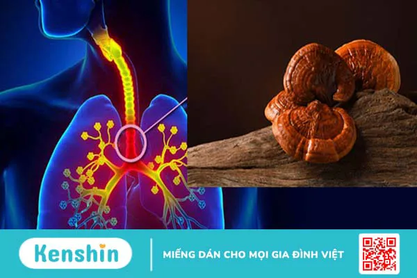 14 bài thuốc từ nấm linh chi hỗ trợ trị bệnh tại nhà hiệu quả