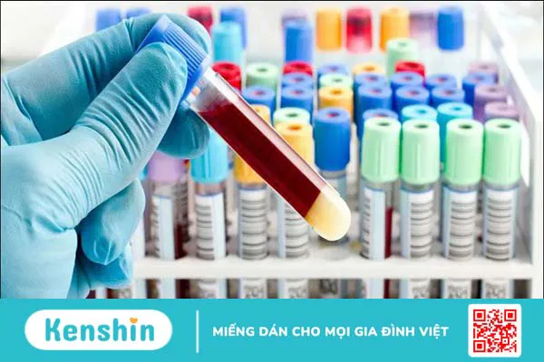 14 cách chữa viêm đại tràng tại nhà đơn giản, hiệu quả và an toàn