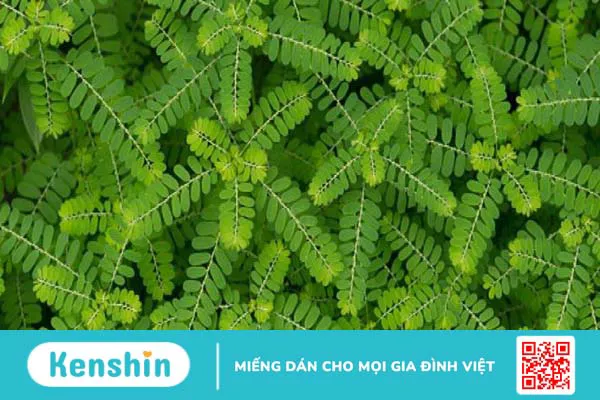 14 cách phòng ngừa sỏi thận hiệu quả giúp bạn khỏe mạnh