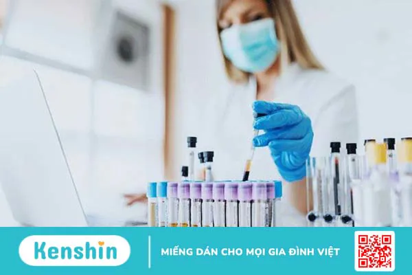 14 cách phòng ngừa sỏi thận hiệu quả giúp bạn khỏe mạnh