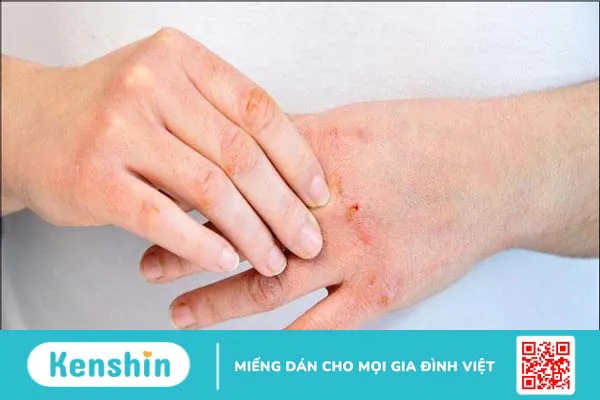 14 mẹo giúp móng tay chắc khỏe bạn nên bỏ túi ngay