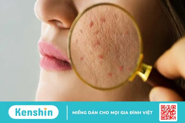 14 sai lầm khi dùng mỹ phẩm ảnh hưởng xấu đến da mà chị em nên tránh