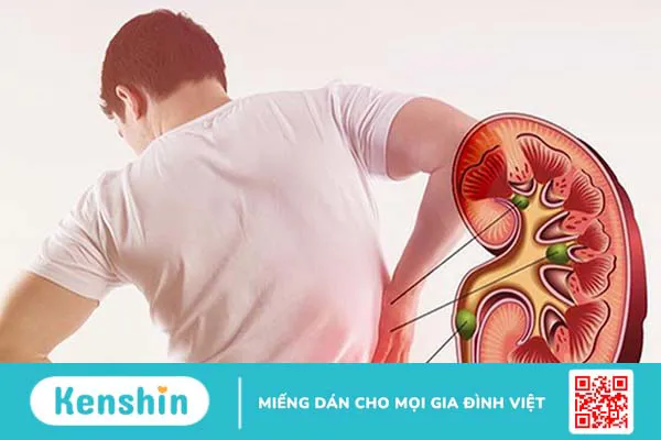 14 tác dụng của cà tím và lưu ý cách dùng để loại bỏ độc hại