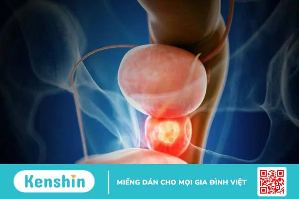 14 tác dụng của nghệ đối với sức khỏe bạn nên biết