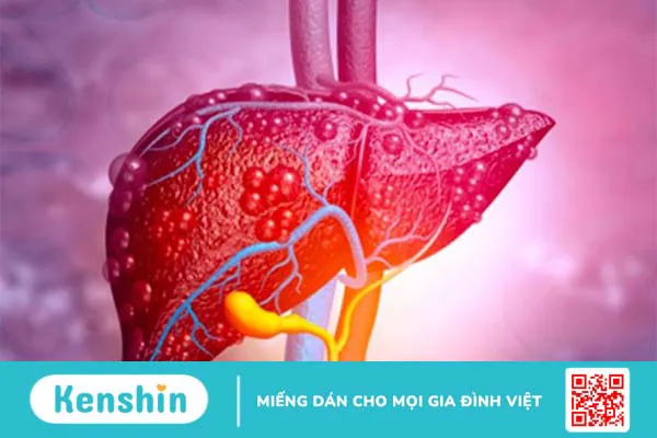 14 tác hại của thuốc giảm cân đối với cơ thể bạn cần biết