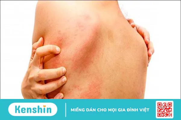 14 tác hại của thuốc giảm cân đối với cơ thể bạn cần biết