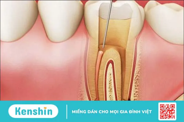 15 bệnh lý răng miệng thường gặp, nguyên nhân và cách điều trị